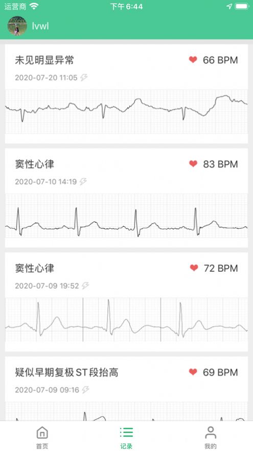 粤健通小程序是官方app最新 v1.0